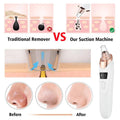 Electric Blackhead Remover Vacuum Pore Cleaner 5 Suction Heads - Front View